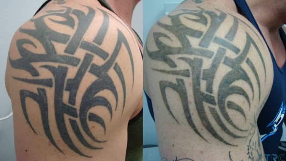 tetoválás fakulás