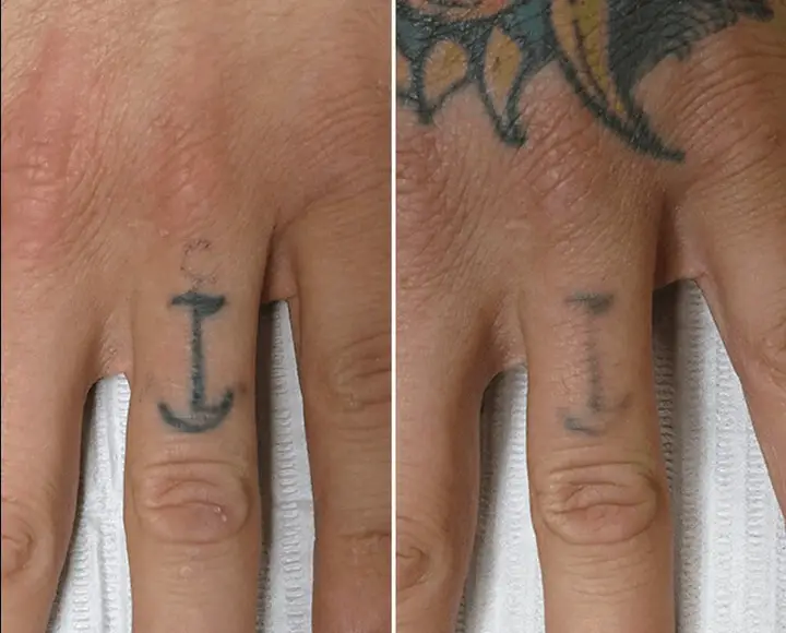 fakuló ujj tetoválás